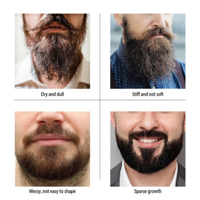 THIKURA Customized Men Care Beard Growth Balm & Serum Set product image