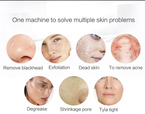 THIKURA Blackhead Remover product image