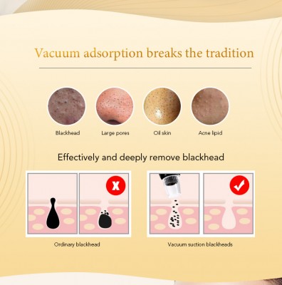 THIKURA Blackhead Remover product image